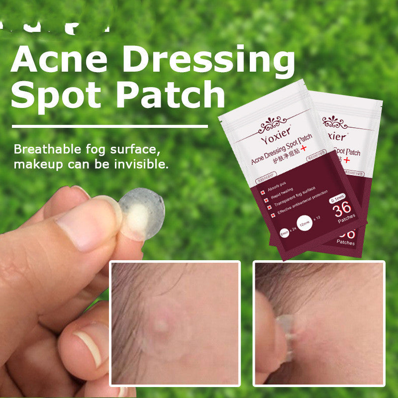 Acne Care Tools & Cream Kit