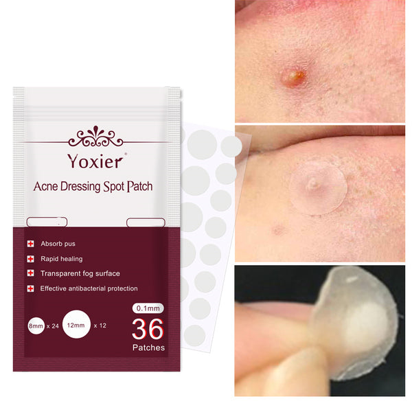 Acne Care Tools & Cream Kit