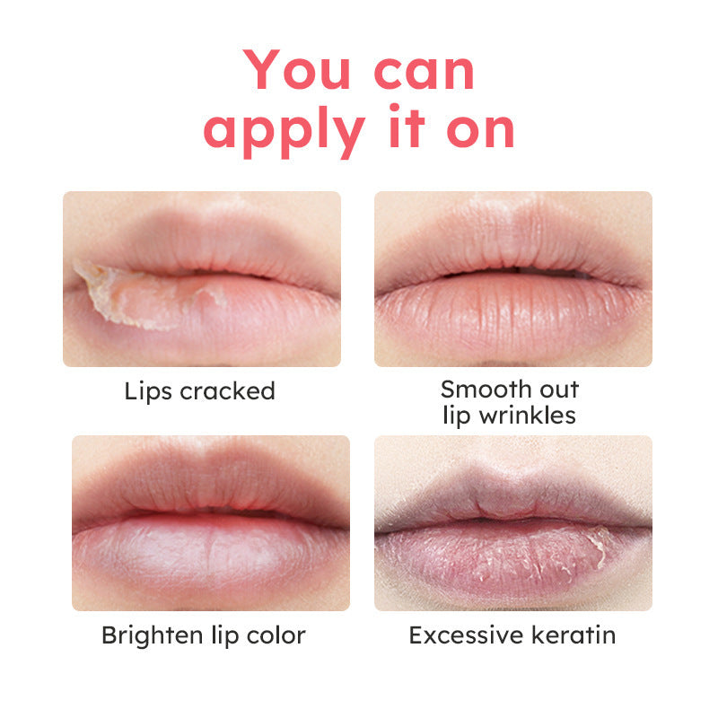 Anti-chapping Lip Care